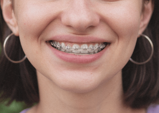 Clínica de ortodoncia en Málaga - Especialistas en tratamientos ortodónticos